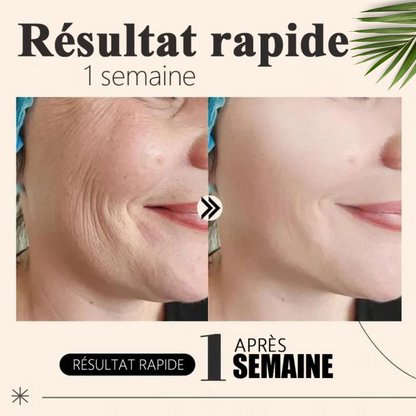 Pack Masque Collagène FontanaySkin™
