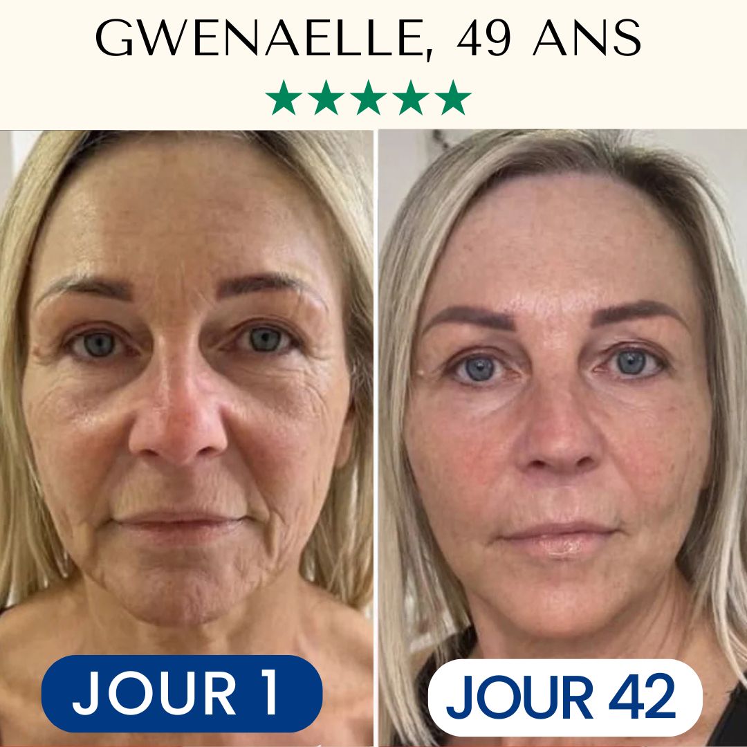 Pack Masque Collagène FontanaySkin™