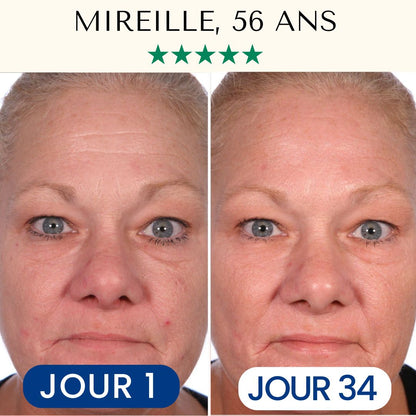Masque Collagène FontanaySkin™