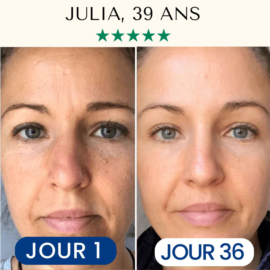 Pack Masque Collagène FontanaySkin™