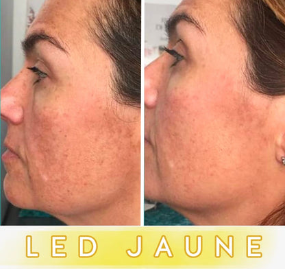 Masque LED Anti-Âge Pro - Visage
