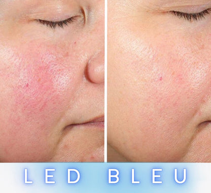 Masque LED Anti-Âge Pro - Visage