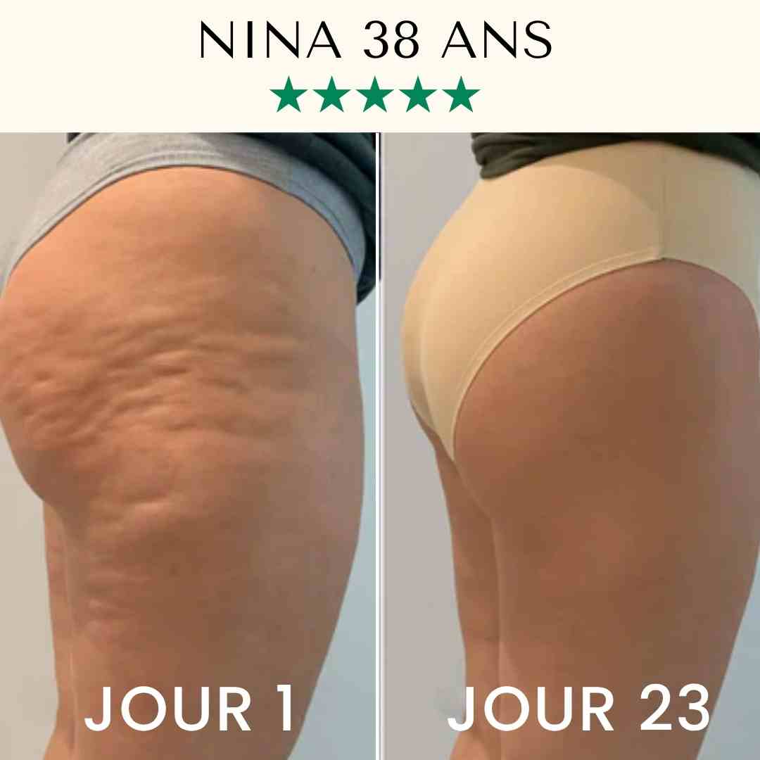 Huile Liftante Corps - Elixir Intense FontanaySkin™