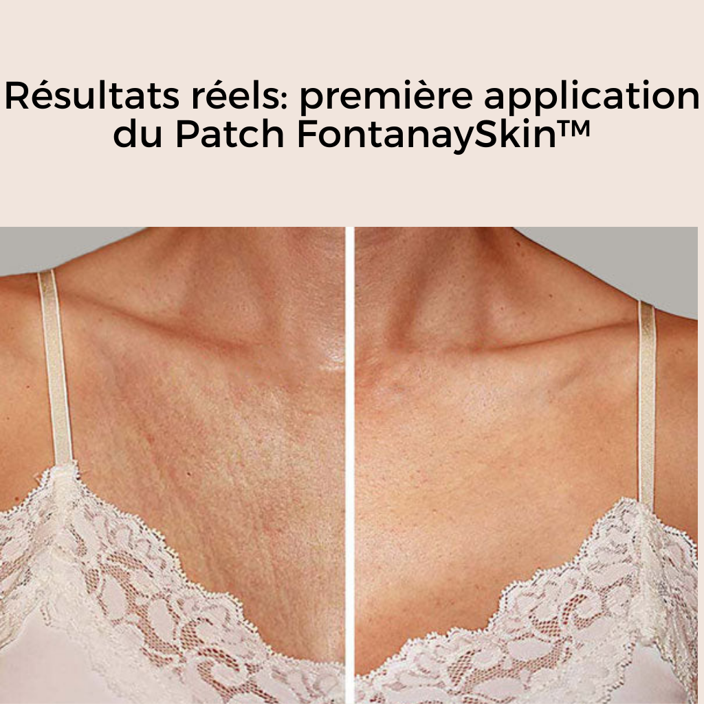 Patchs Cou et Decolleté Anti-Rides Réutilisables FontanaySkin™