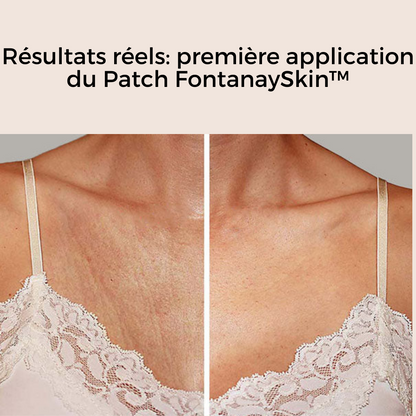 Patchs Cou et Decolleté Anti-Rides Réutilisables FontanaySkin™